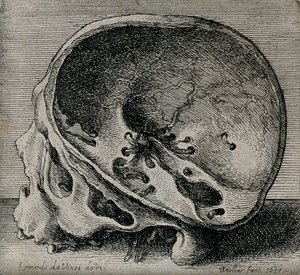 Dwarsdoorsnede van schedel in profiel